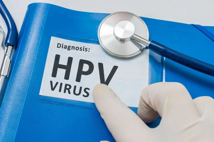 virus del papiloma humano