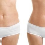 Hidrolipoclasia la Liposucción del Futuro