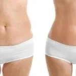 Hidrolipoclasia la Liposucción del Futuro