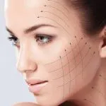 Fibroblast nuevo tratamiento cosmetico