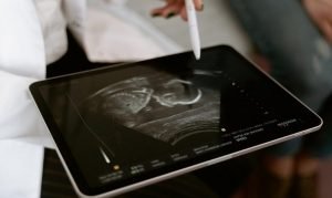 Controla la salud de tu bebé durante tu embarazo