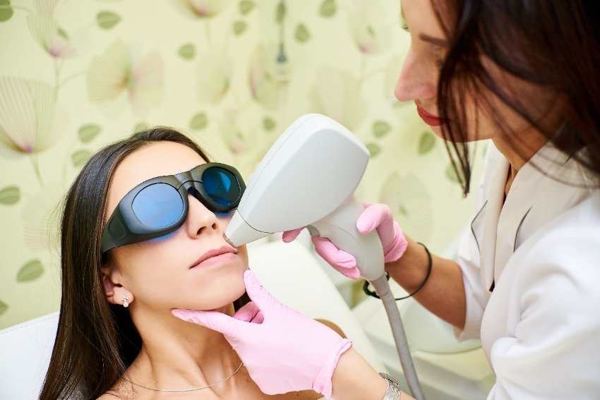 depilacion laser