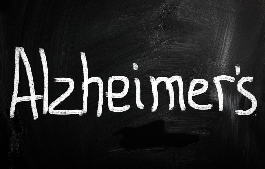 ¿Qué es la enfermedad de Alzheimer? 1 enfermedad de Alzheimer