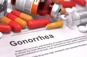 Gonorrea o Blenorragia