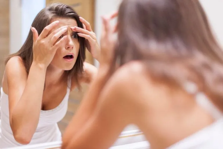 tratamientos cosmeticos de la acne