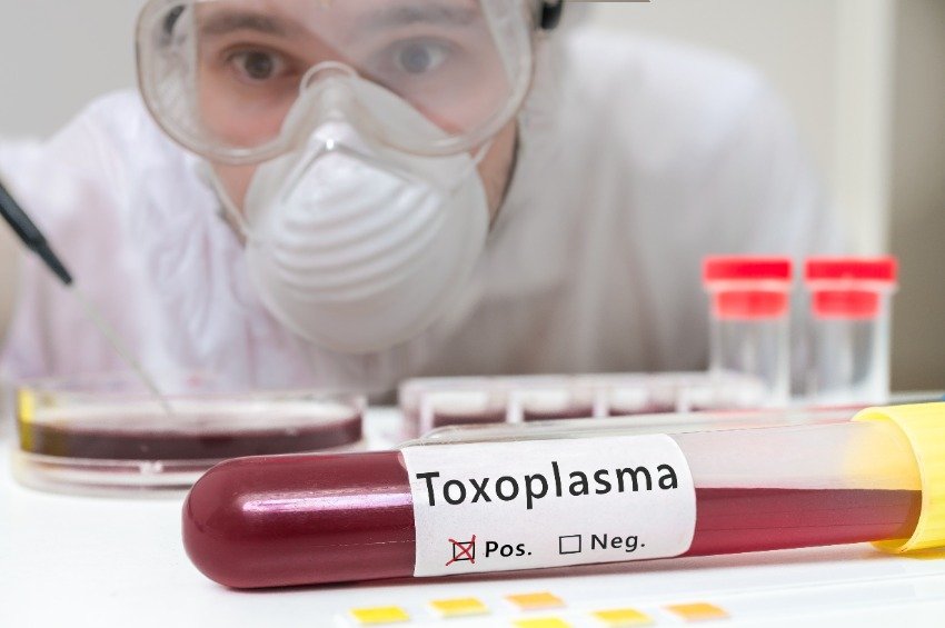 Toxoplasmosis en el embarazo 1 Toxoplasmosis en el embarazo