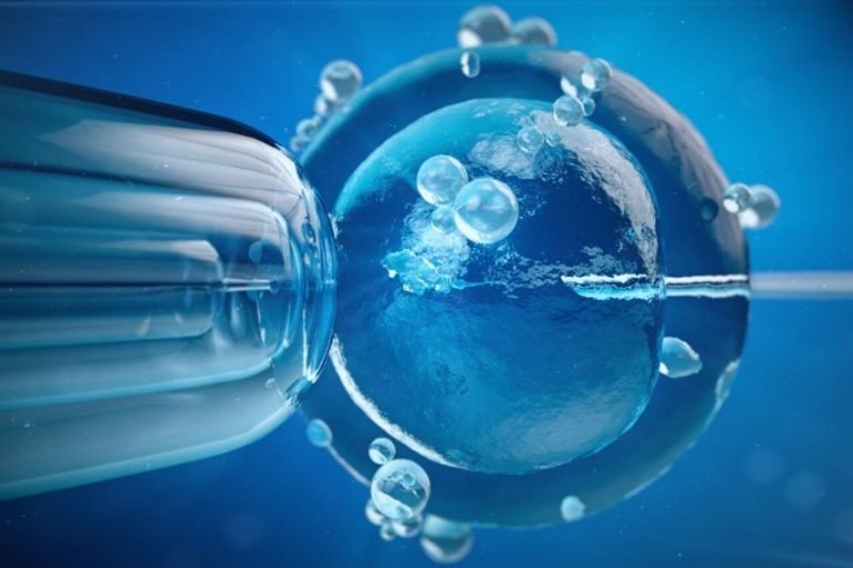 Fertilización asistida