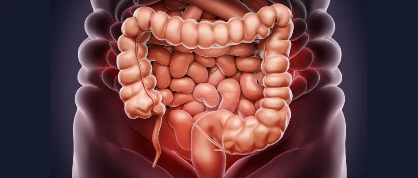 limpieza de colon